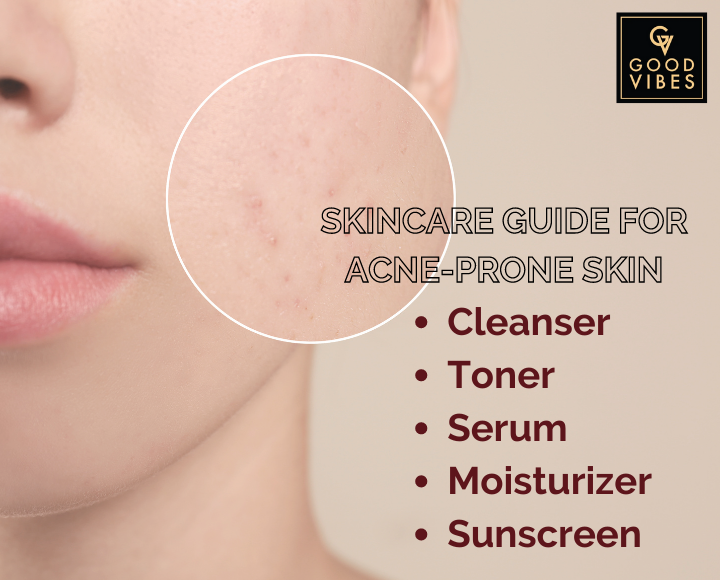 Skincare Routines To Get Rid Of Acne Prone Skin - Image contain women face with acne prone pointers
